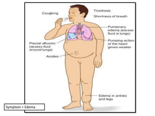 Symptom = Edema 
 