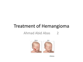 Treatment of Hemangioma
    Ahmad Abid Abas   2
 
