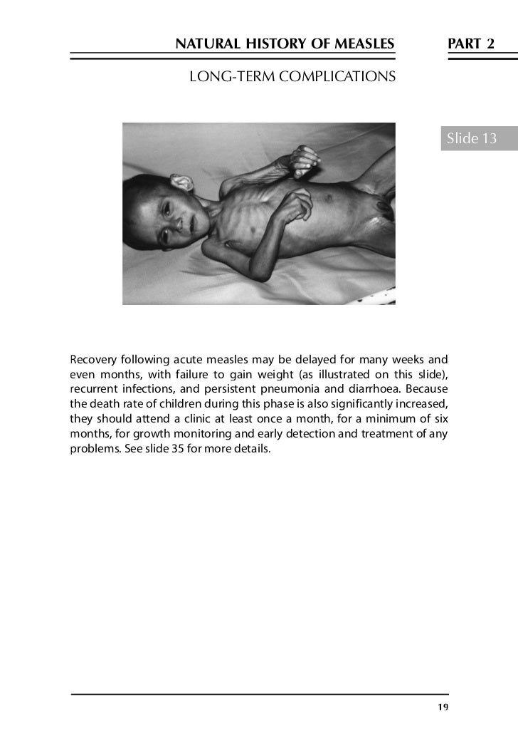 Natural Pneumonia Treatment Part Natural Pneumonia Treatment Part