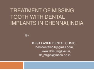 TREATMENT OF MISSING
TOOTH WITH DENTAL
IMPLANTS IN CHENNAI,INDIA
By,
BEST LASER DENTAL CLINIC,
bestdentalno1@gmail.com,
www.drmurugavel.in,
dr_mrgvl@yahoo.co.in
 