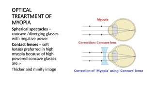 TREATMENT_OF_PATHOLOGICAL_MYOPIA[1].pptx