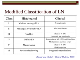 Treatment of Systemic Lupus | PPT