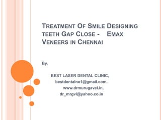 TREATMENT OF SMILE DESIGNING
TEETH GAP CLOSE - EMAX
VENEERS IN CHENNAI
By,
BEST LASER DENTAL CLINIC,
bestdentalno1@gmail.com,
www.drmurugavel.in,
dr_mrgvl@yahoo.co.in
 