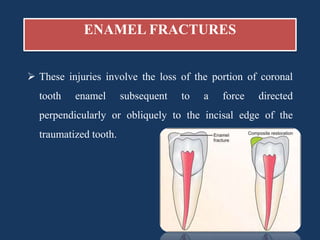 Enamel Infarctions Treatment of traumatised tooth | PPTX