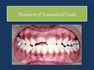 Treatment of Traumatized Tooth
 