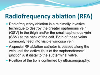 Endovenous Thermal Ablations | PPTX