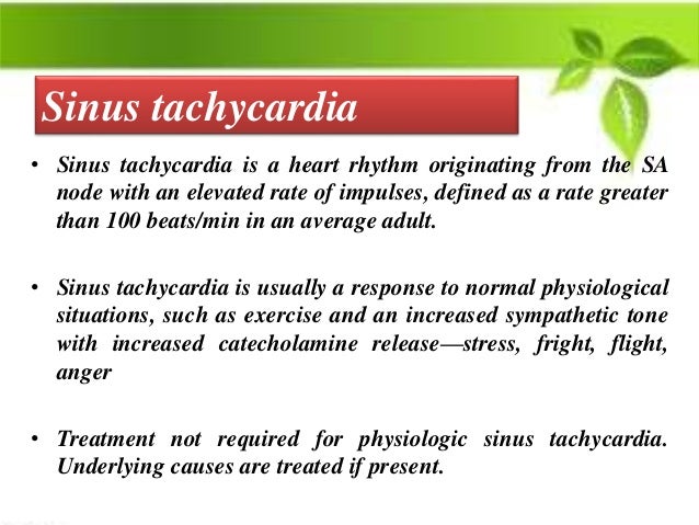 Treatment Of Various Arrhythmias Treatment Of Various Arrhythmias