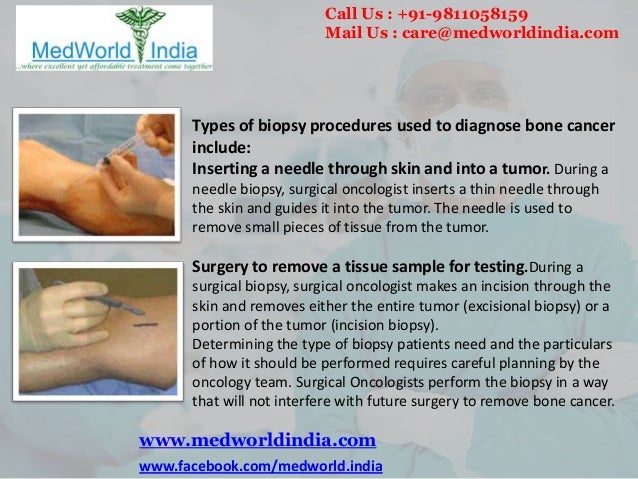 Treatment Options for Bone Cancer At World Best Cancer