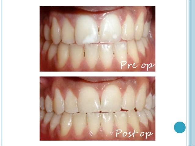 Dental care case study 2 answers picture