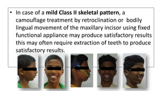 • In case of a mild Class II skeletal pattern, a
camouflage treatment by retroclination or bodily
lingual movement of the maxillary incisor using fixed
functional appliance may produce satisfactory results
this may often require extraction of teeth to produce
satisfactory results.
 