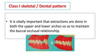 Class I skeletal / Dental pattern
• It is vitally important that extractions are done in
both the upper and lower arches so as to maintain
the buccal occlusal relationship.
 