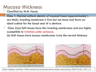 Mucous Classification Treatment Planning and diagnosis patient | PPTX