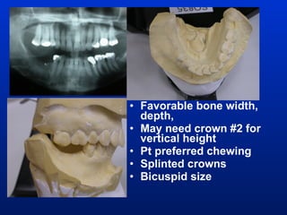 Favorable bone width, depth,  May need crown #2 for vertical height Pt preferred chewing Splinted crowns Bicuspid size 