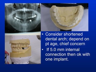 Consider shortened dental arch; depend on pt age, chief concern If 5.0 mm internal connection then ok with one implant. 