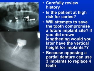 Carefully review history Is the patient at high risk for caries? Will attempts to save the tooth compromise a future implant site? If you did crown lengthening would you later have the vertical height for implants?? Because opposing a partial denture can use 3 implants to replace 4 teeth . 