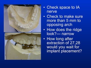Check space to IA nerve Check to make sure more than 5 mm to opposing arch How does the ridge look?--- narrow How long after extraction of 27,28 would you wait for implant placement? 
