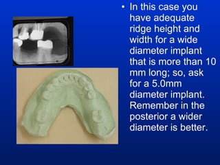 In this case you have adequate ridge height and width for a wide diameter implant that is more than 10 mm long; so, ask for a 5.0mm diameter implant. Remember in the posterior a wider diameter is better. 