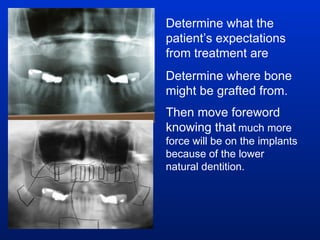 Determine what the patient’s expectations from treatment are Determine where bone might be grafted from. Then move foreword knowing that   much more force will be on the implants because of the lower natural dentition. 