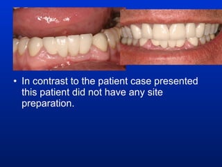 In contrast to the patient case presented this patient did not have any site preparation. 