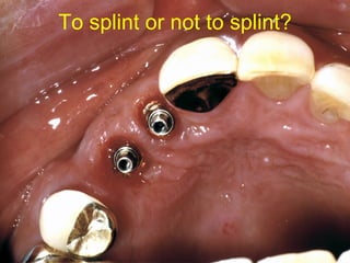 To splint or not to splint? 