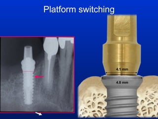 Platform switching 4.8 mm 4.1 mm 