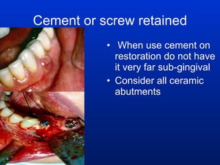 Cement or screw retained When use cement on restoration do not have it very far sub-gingival Consider all ceramic abutments 