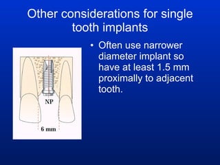 Other considerations for single tooth implants Often use narrower diameter implant so have at least 1.5 mm proximally to adjacent tooth. 