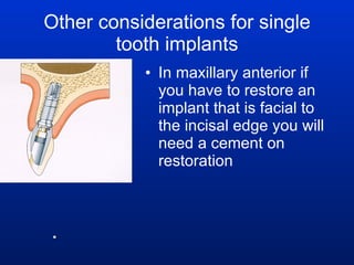 Other considerations for single tooth implants In maxillary anterior if you have to restore an implant that is facial to the incisal edge you will need a cement on restoration 