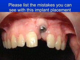 Please list the mistakes you can see with this implant placement 