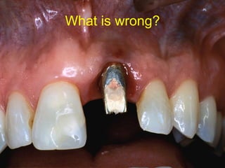 What is wrong? 