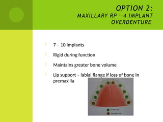 Maxillary Rp Treatment planning for the edentulous maxilla.pptx