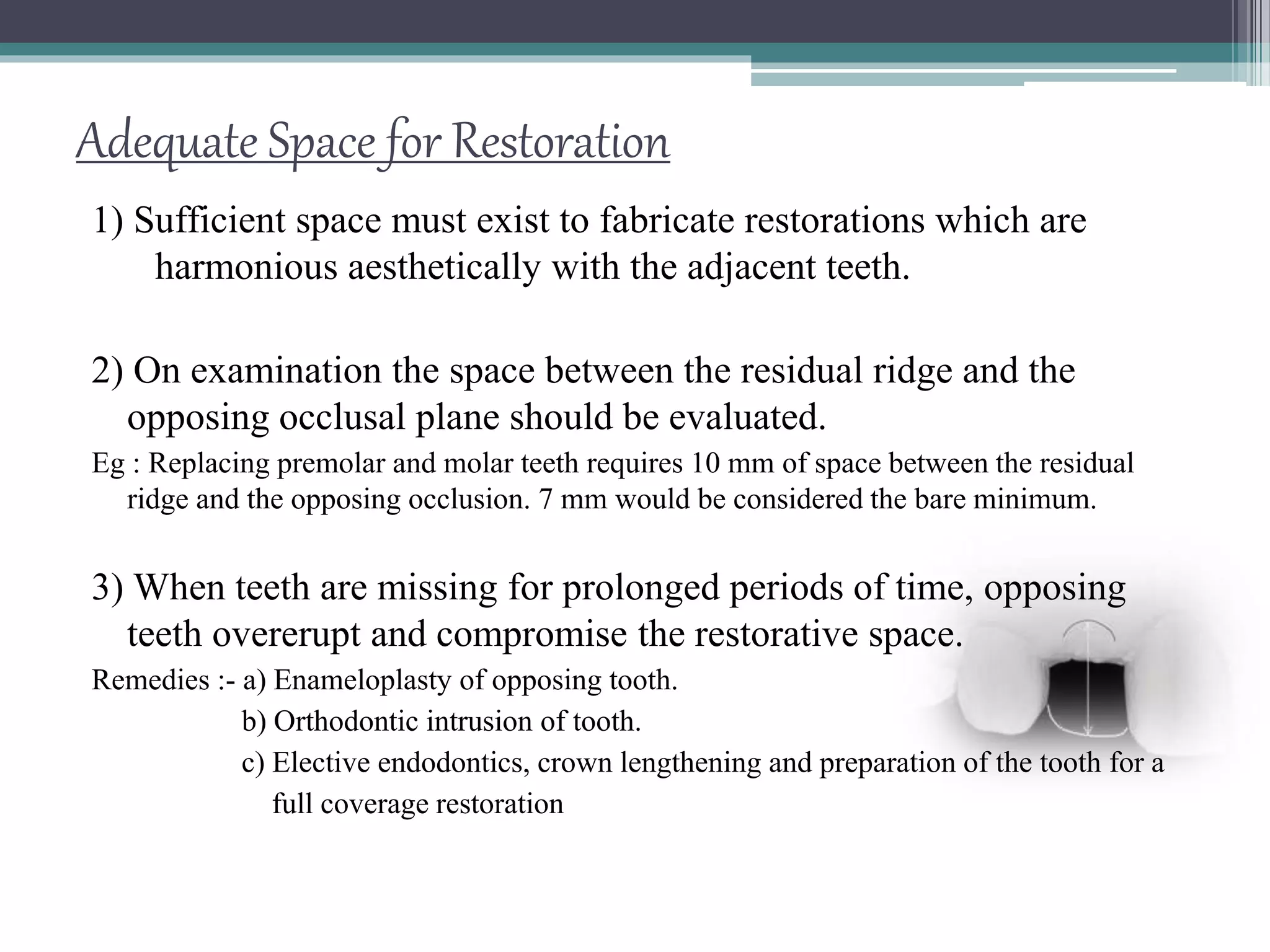 Sufficient Ridges Treatment Planning of Implants in Posterior Quadrants | PPTX