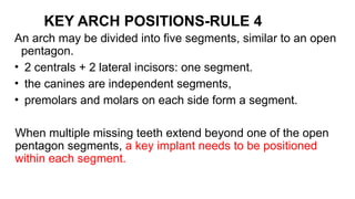 Treatment Plans Related to Key implant position and implant number - Dr ...