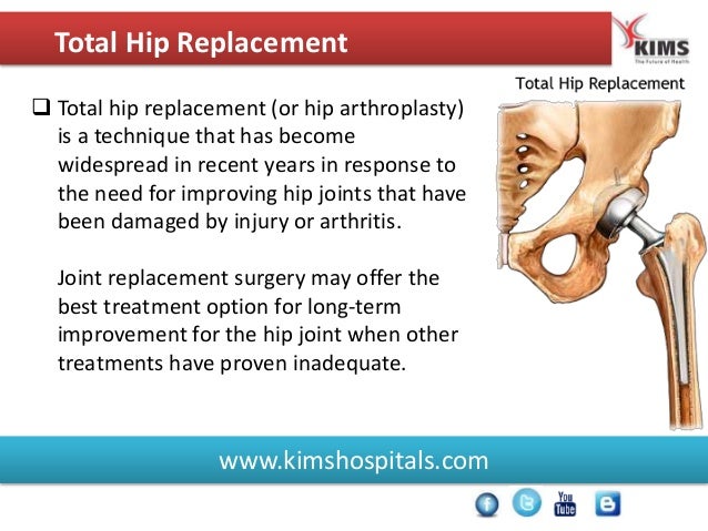 Hip Knee Replacement Surgery Procedure @ KIMS Hospitals