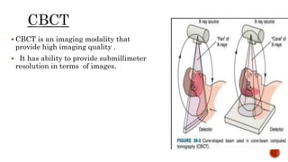 Cbct Resolution Treatment verification systems in radiation therapy | PPTX