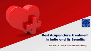 Website URL-www.acupunctureindia.org
Best Acupuncture Treatment
in India and Its Benefits
 