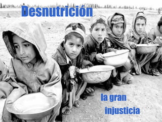 Desnutrición la gran  injusticia 