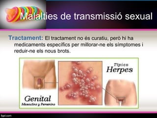 Malalties de transmissió sexual

Tractament: El tractament no és curatiu, però hi ha
  medicaments específics per millorar-ne els símptomes i
  reduir-ne els nous brots.
 