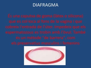 DIAFRAGMA

 És una caputxa de goma (làtex o silicona)
  que es col·loca al fons de la vagina i que
cobreix l'entrada de l'úter. Impedeix que els
espermatozous es trobin amb l'òvul. També
      és un mètode "de barrera", com
   els preservatius masculins i femenins
 