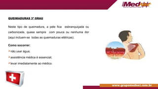 QUEIMADURAS 3º GRAU
Neste tipo de queimadura, a pele fica esbranquiçada ou
carbonizada, quase sempre com pouca ou nenhuma dor
(aqui incluem-se todas as queimaduras elétricas).
Como socorrer:
não usar água;
assistência médica é essencial;
levar imediatamente ao médico.
 