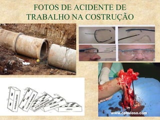 FOTOS DE ACIDENTE DE
TRABALHO NA COSTRUÇÃO
 
