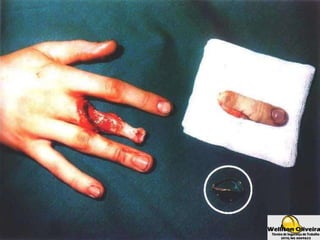 Gilberto Ferreira Morais –
TST – Jataí•GO
 