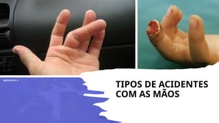 TIPOS DE ACIDENTES
COM AS MÃOS
 