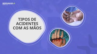 TIPOS DE
ACIDENTES
COM AS MÃOS
 