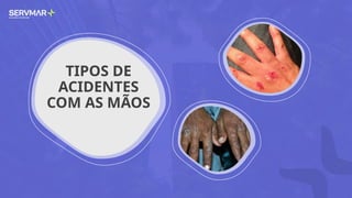 TIPOS DE
ACIDENTES
COM AS MÃOS
 