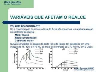 VARIÁVEIS QUE AFETAM O REALCE VOLUME DO CONTRASTE Se a concentração do iodo e a taxa de fluxo são mantidas, um  volume maior  do contraste conduz a:  Maior realce  Realce prolongado   Cobertura maior Curvas simuladas do realce da aorta (a) e do fígado (b) baseados em uma injeção de 75, 125, e 175 mL do meio de contraste de 370 mg/mL em 2 L/sec.   