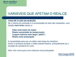 VARIÁVEIS QUE AFETAM O REALCE Se o volume do contraste e a concentração do iodo são constantes, uma injeção  mais lenta  conduz a:  Valor mais baixo do realce  Realce aumentado do tempo-à-pico  Largura máxima mais larga (“platô”)  Realce mais prolongado A necessidade para que um delay mais longo da varredura  Iniciar a varredura durante o realce arterial máximo, prinicpalmente se a duração da varredura for curta. Nota: Isto é bom para uma cobertura mais prolongada.  TAXA DE FLUXO DA INJEÇÃO 