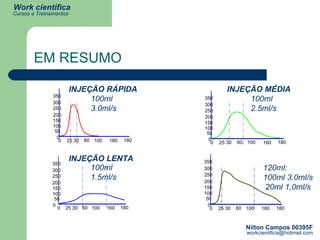EM RESUMO INJEÇÃO RÁPIDA 0 50 100 150 200 250 300 350 0 25 30 60 100 160 180 100ml 3.0ml/s 0 50 100 150 200 250 300 350 0 25 30 60 100 160 180 100ml 2.5ml/s INJEÇÃO MÉDIA INJEÇÃO LENTA 0 50 100 150 200 250 300 350 0 25 30 60 100 160 180 100ml 1.5ml/s 0 50 100 150 200 250 300 350 0 25 30 60 100 160 180 120ml: 100ml 3.0ml/s 20ml 1,0ml/s 