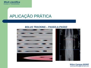 APLICAÇÃO PRÁTICA BOLUS TRACKING – PASSO-A-PASSO 
