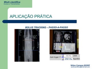 APLICAÇÃO PRÁTICA BOLUS TRACKING – PASSO-A-PASSO 250 Hu 